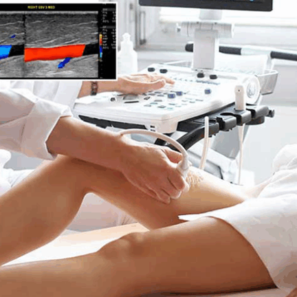 ECOGRAFIA-VASCULAR-IMAGEM-SITE